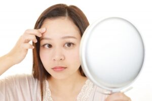 当院のニキビ治療の特徴