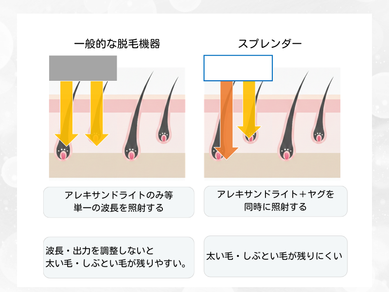 スプレンダーX 特徴 波長