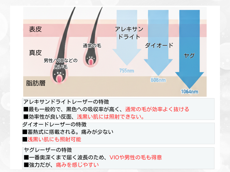 医療脱毛で使用されるレーザーの波長