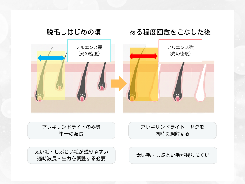 医療脱毛 フルエンス