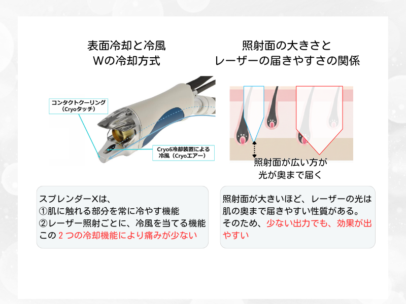 スプレンダーX 痛み