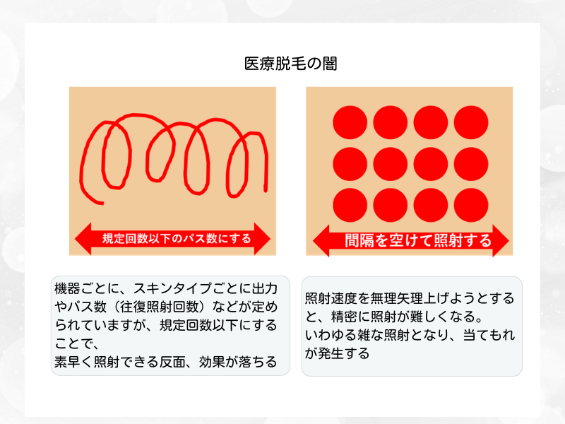 医療脱毛 効果ない