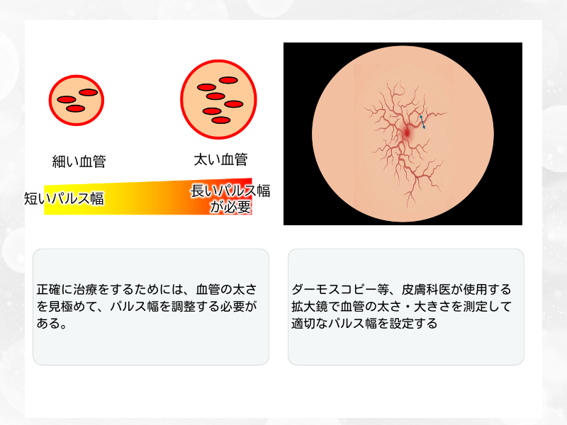 赤ら顔　血管の太さ　測定