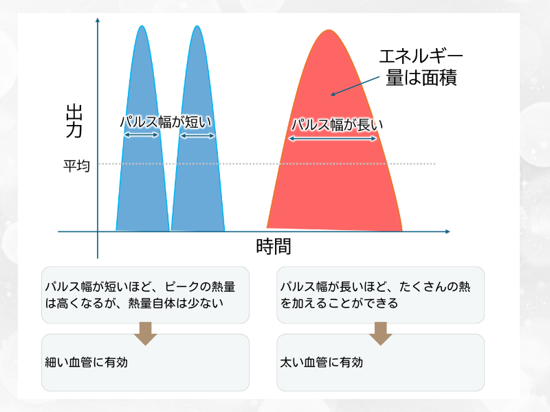 Vビーム　パルス幅